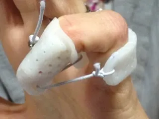 imgi 17 Splint finger flex IMG 1439
